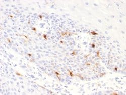 TYRP1 Antibody (TYRP1/2340R) - Azide and BSA Free, Novus Biologicals 100 &mu;g | Buy Online | Novus Biologicals | Fisher Scientific
